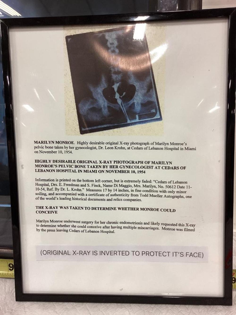 Marilyn Monroe X-ray displayed with provenance information identifying it as an original 1954 X-ray associated with her treatment at Cedars of Lebanon Hospital.